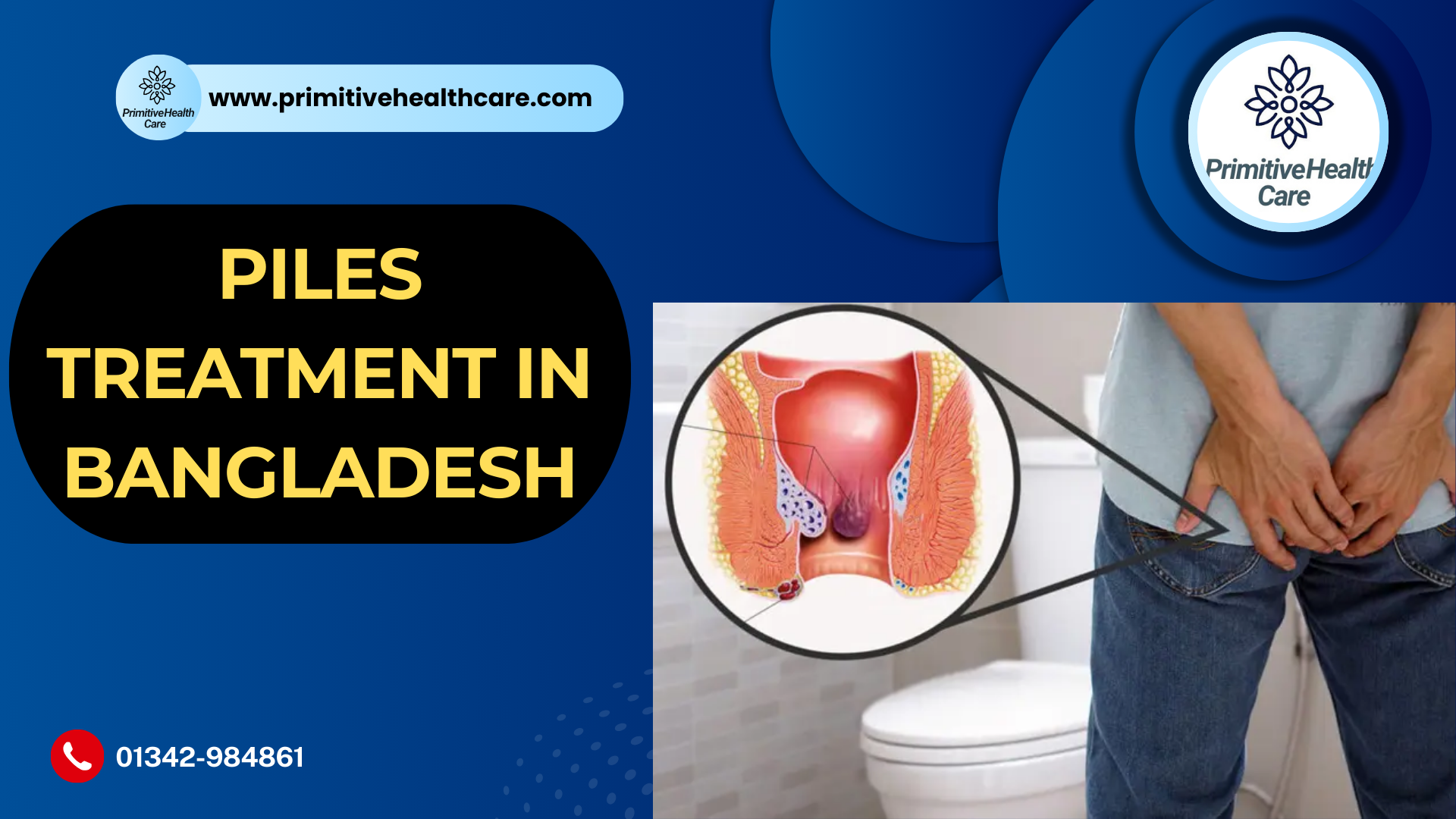 Piles Treatment in Bangladesh